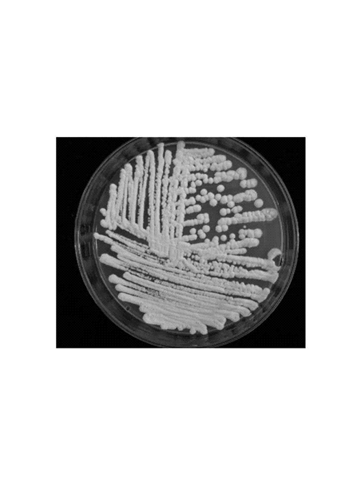 扣囊复膜孢酵母