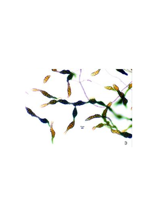 蜡蚧轮枝孢菌